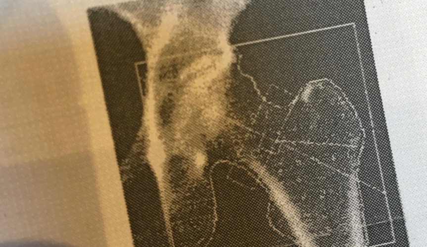 Your Habits When You’re Young Put Your Bones at Risk When You’re&nbsp;Older